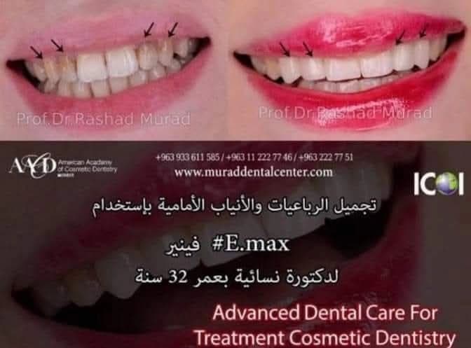 الرعاية السنية المتطورة